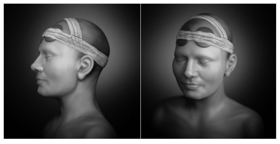 Reconstrução facial do crânio demonstrando o tipo de deformação — Foto: Moraes et al