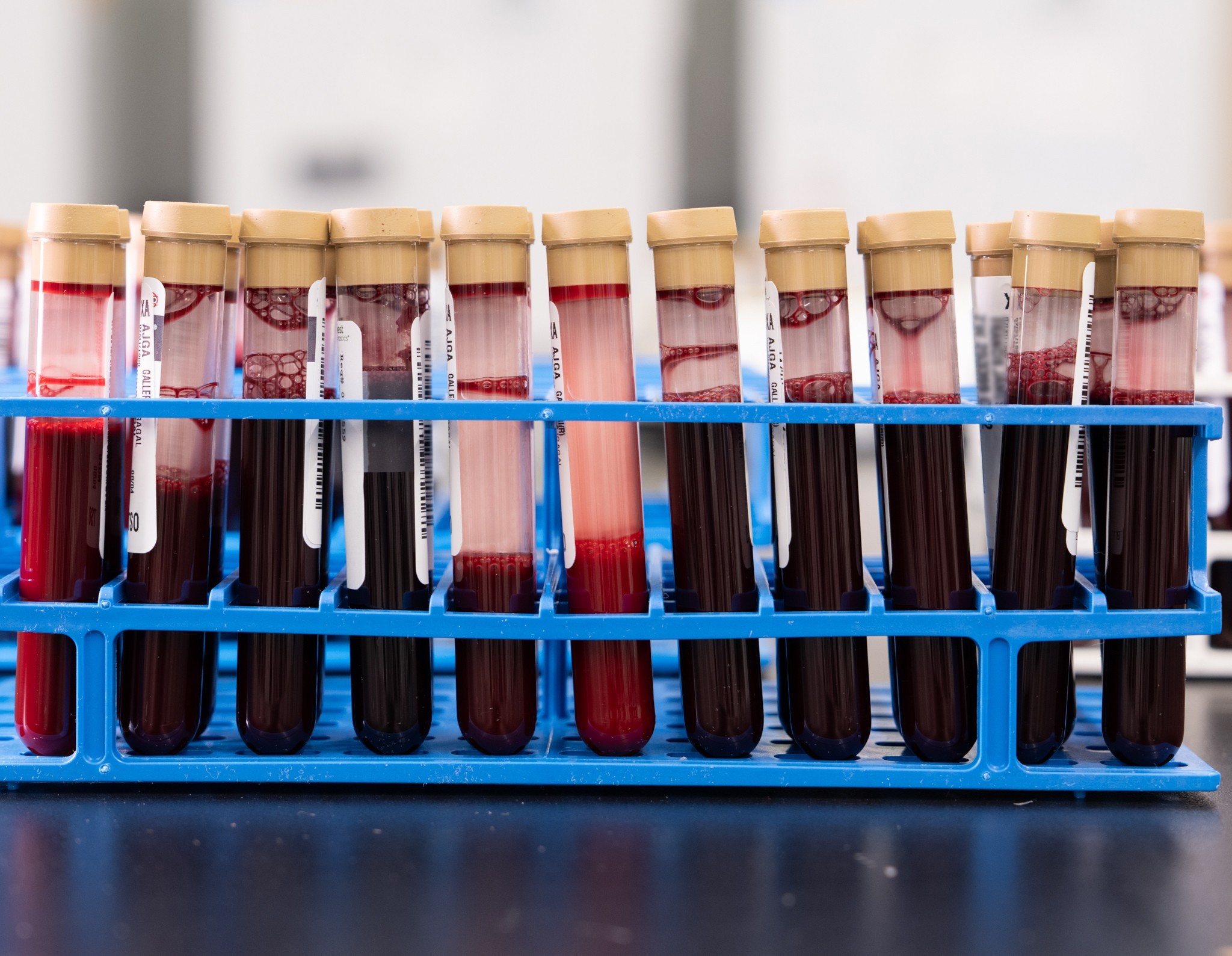 Chega ao Brasil novo exame de sangue que pode identificar 50 tipos de câncer