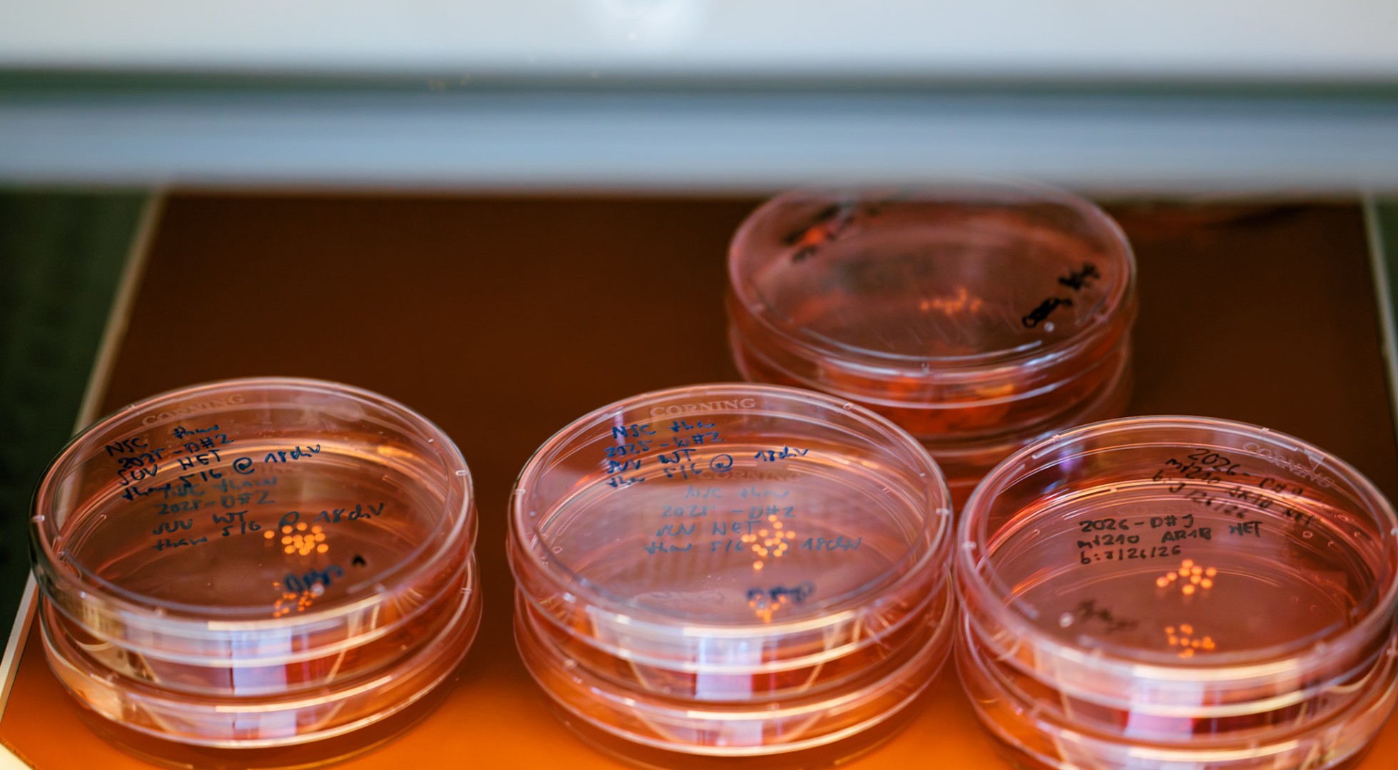 Imagem ilustrativa de organoide cerebral humano cultivado em laboratório