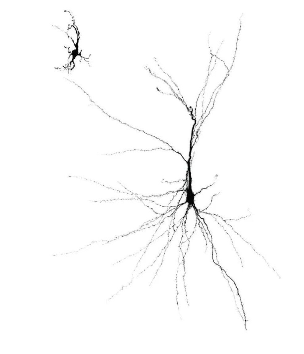 Neurônios humanos criados a partir de células-tronco e implantados em cérebro de rato (à direita) crescem mais do que aqueles cultivados em um prato (à esquerda) (Foto: Universidade de Stanford) — Foto: Galileu