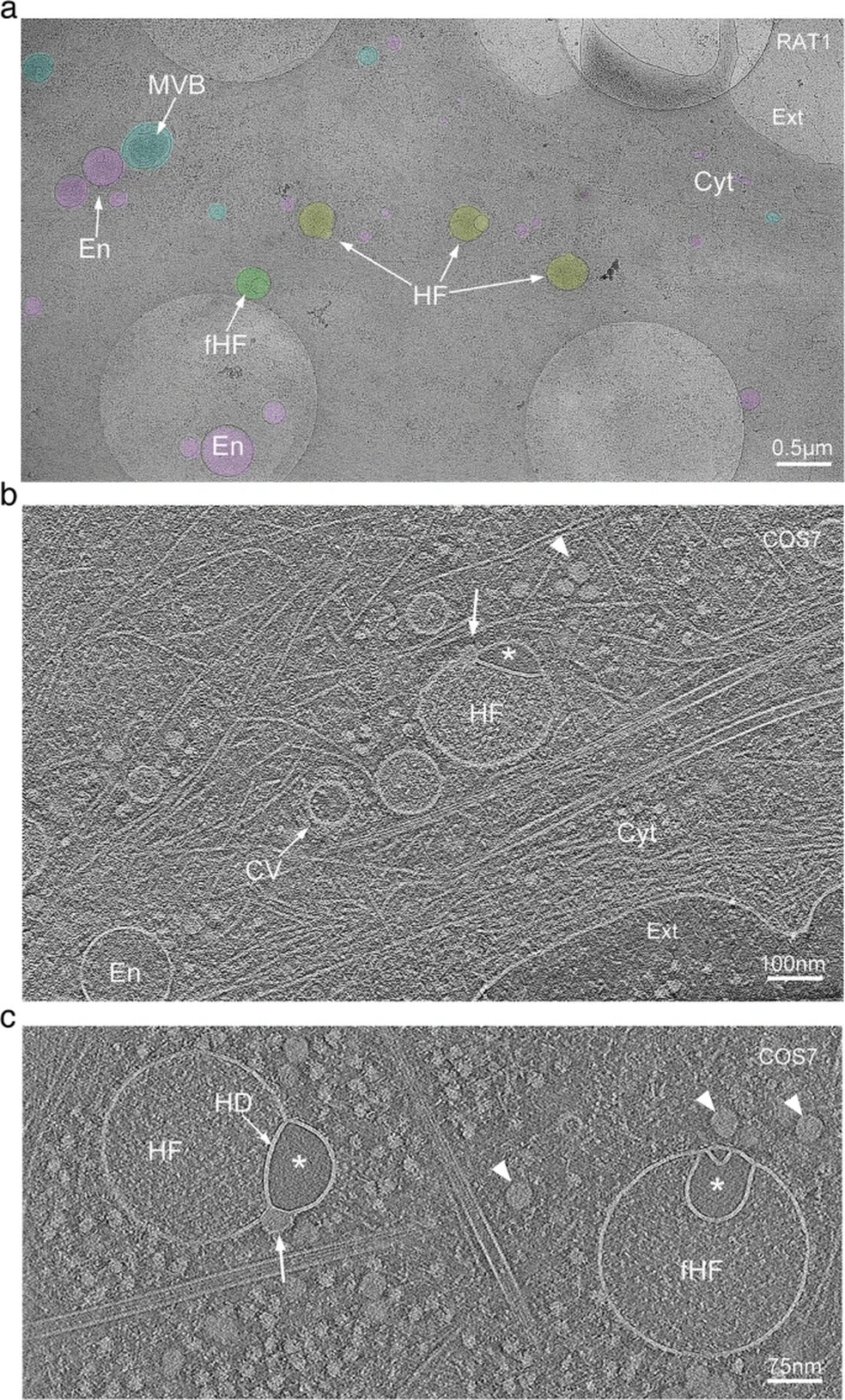 Observação por tomografia crioeletrônica de vesículas hemifundidas na borda anterior de células cultivadas — Foto: Nature Communications/Amirrasoul Tavakoli et.al