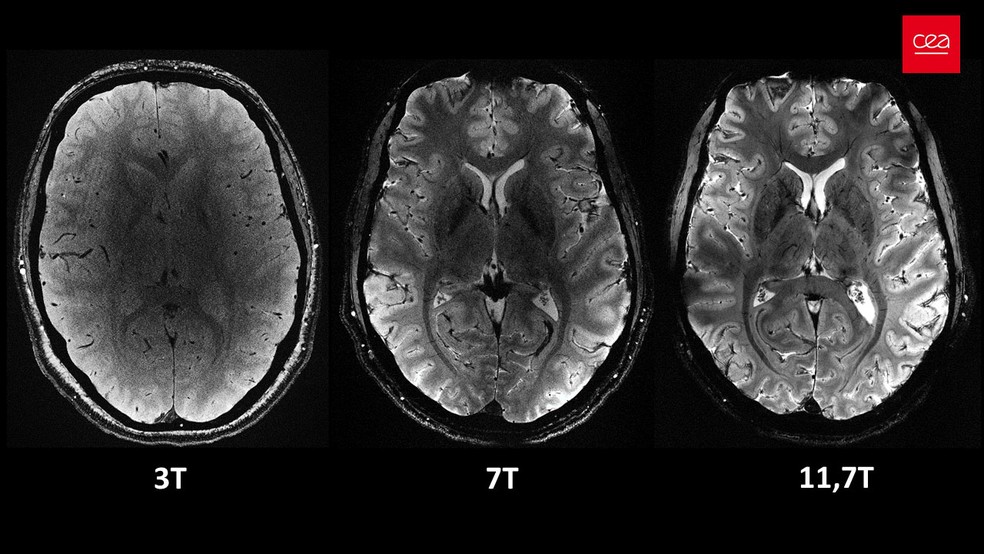 Imagens do cérebro humano vistas de cima e demostrando a maior resolução com o aumento de teslas — Foto: CEA