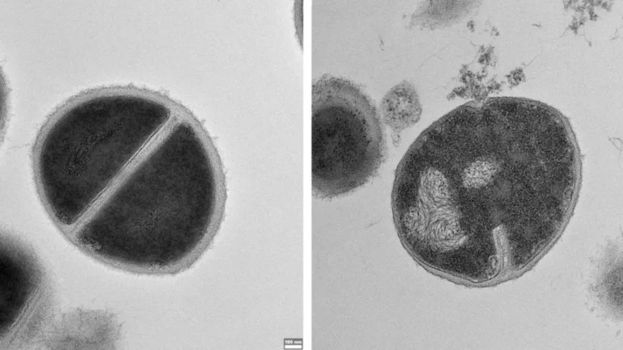 Bactérias Staphylococcus, uma saudável à esquerda e outra sendo destruída quando sua camada externa é rompida por antimicrobianos produzidos pelo proteassoma
