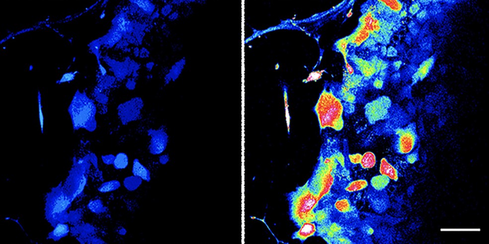 Células do folículo capilar antes (esquerda) e depois da estimulação (direita) — Foto: Agramunt et al.