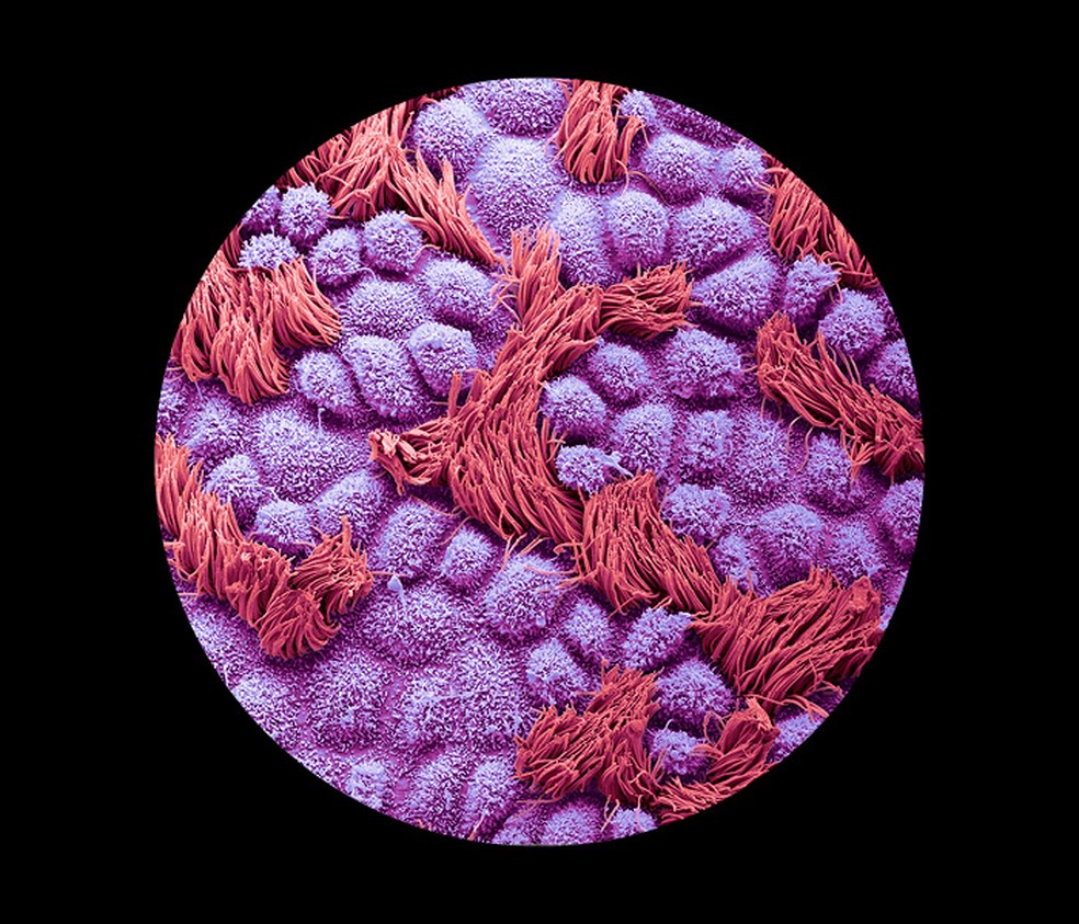 Superfície das trompas uterinas, tubas que ligam os ovários ao útero no aparelho reprodutor feminino — Foto: Getty Images
