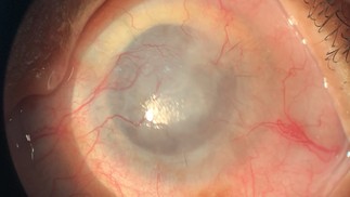 Devido à vascularização, o olho passa a apresentar opacidade — Foto: Magalhães et al.