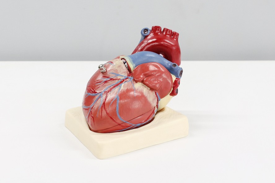 Microplásticos foram detectados em tecidos cardíacos de pacientes submetidos a cirurgias do coração