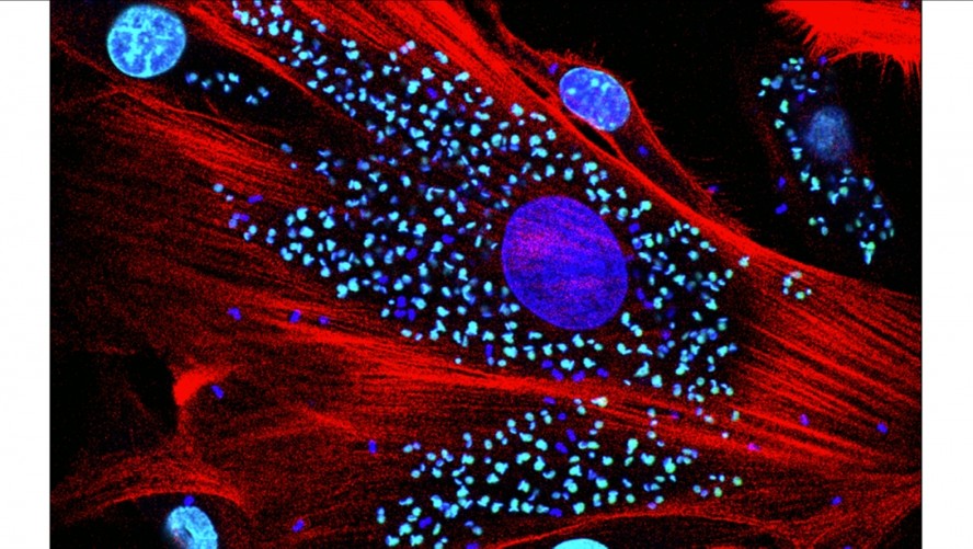 Células de coração infectadas com Trypanosoma cruzi. A estrutura maior (azul) é o núcleo da célula e as menores são os núcleos das células do parasita. Em vermelho, o citoesqueleto da célula cardíaca.