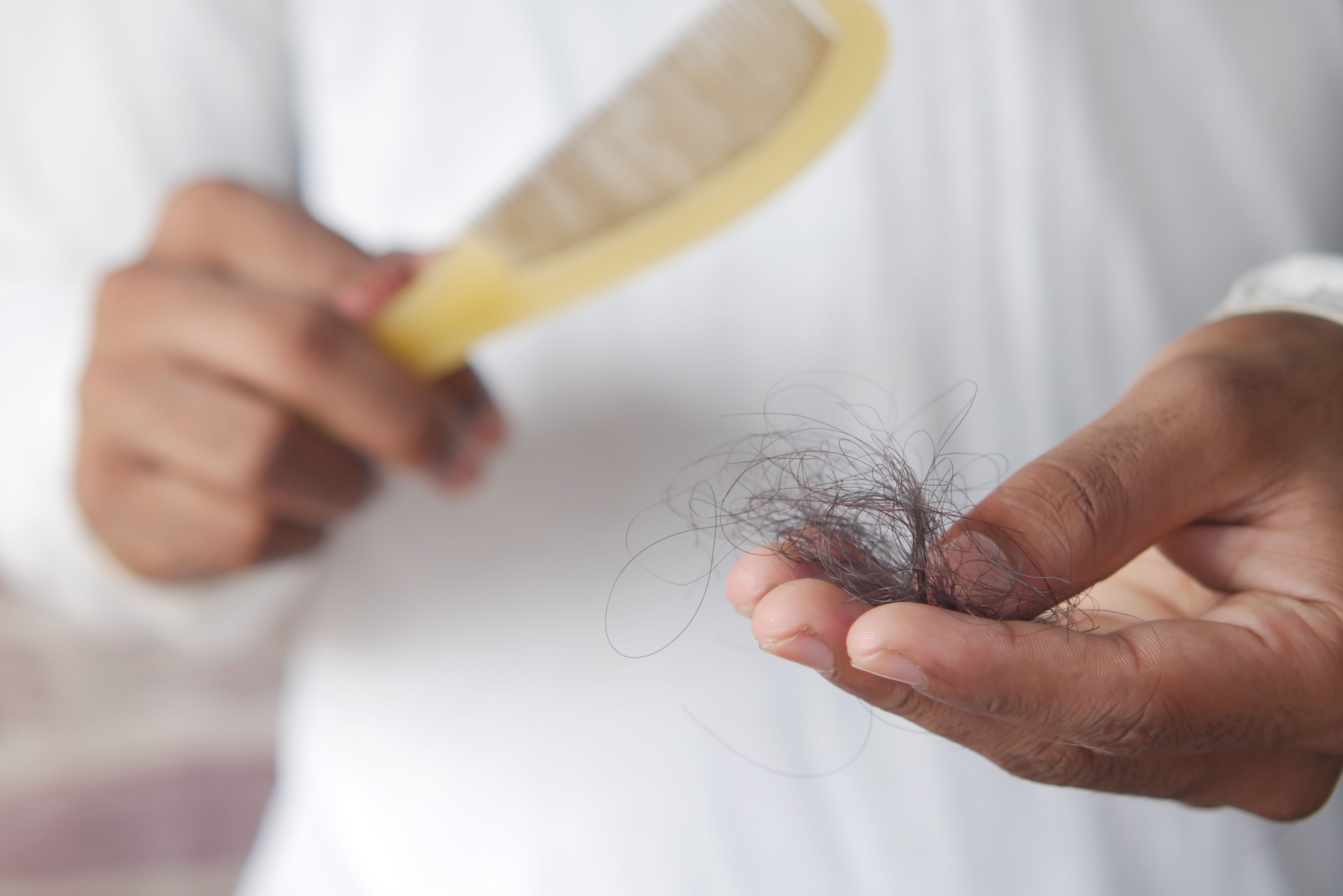 Pílula para perda de cabelo se mostra promissora em testes nos EUA