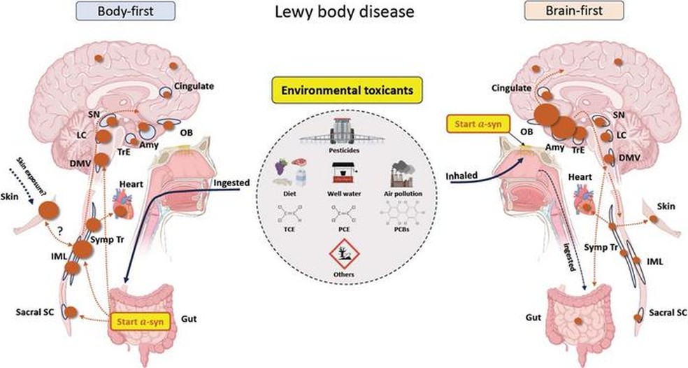 Uma proposta sobre como a exposição ambiental a substâncias tóxicas pode causar a doença de corpos de Lewy que ocorre primeiro no corpo ou no cérebro — Foto: Hospital Universitário de Aarhus/Centro Médico da Universidade de Rochester