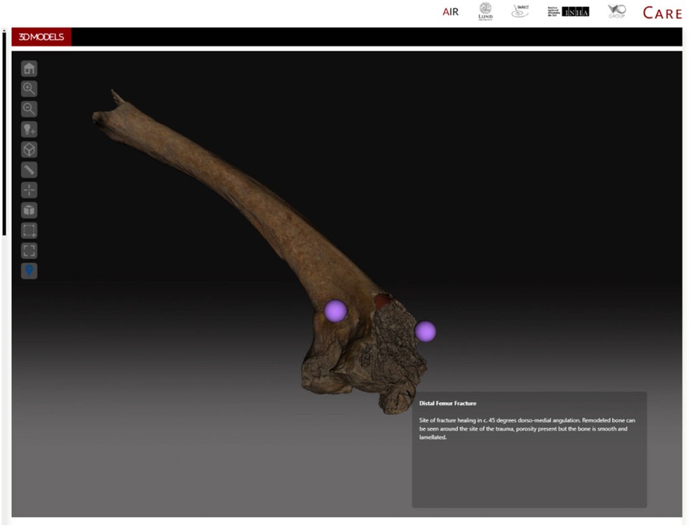 Fêmur esquerdo modelado em 3D, observando a seção distal — Foto: Blair Nolan et.al