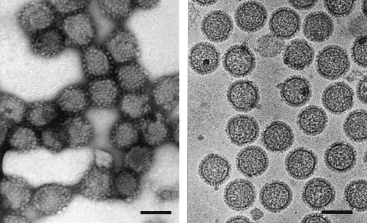 No Peru, jovem contrai vírus jamais visto que causa doença como a dengue | Saúde