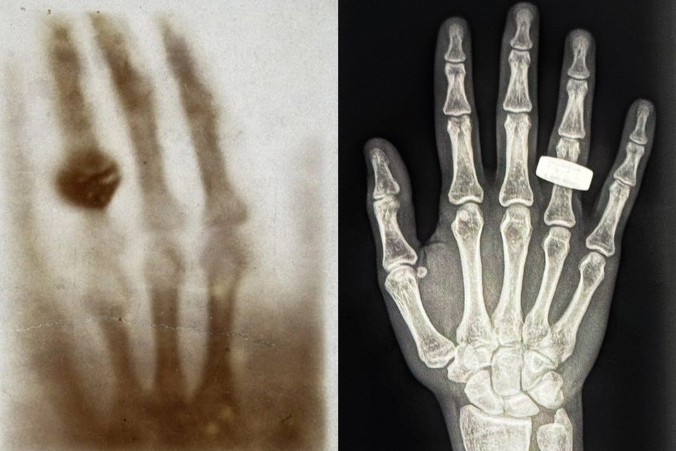 Na foto à esquerda, está o primeiro raio-X médico já tirado, há 130 anos. À direita, a primeira imagem de raio-X tirada no espaço — Foto: Reprodução/X (@satofishi)