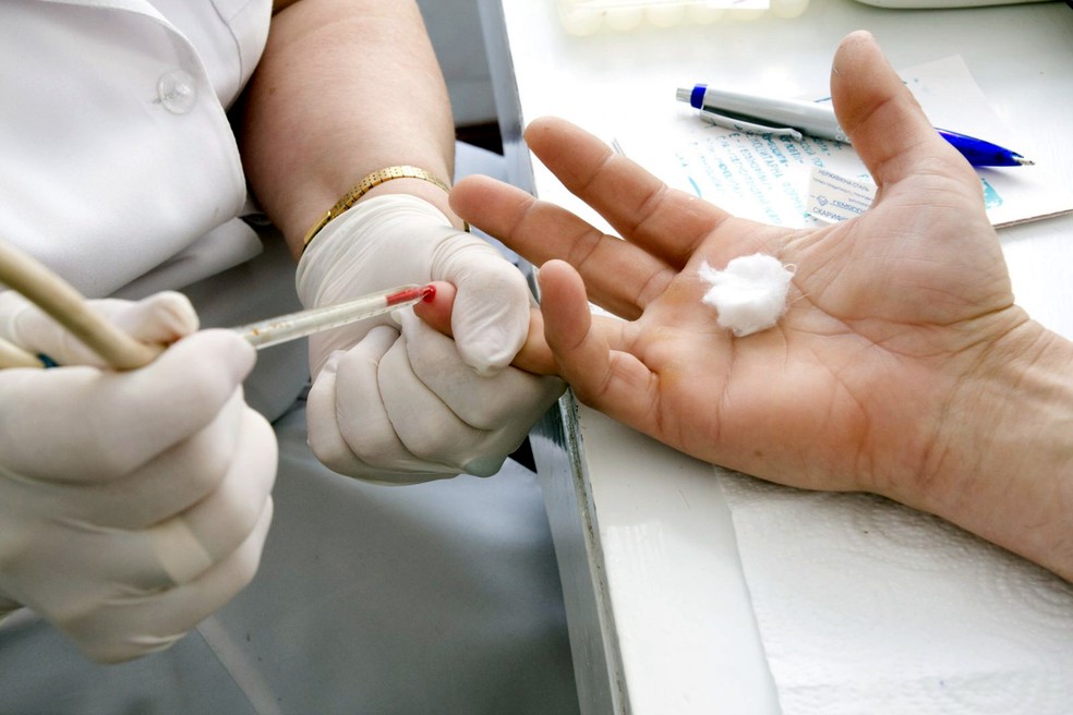 Os resultados do teste rápido para o HIV saem em menos de meia hora — Foto: Divulgação/Governo do Estado de São Paulo