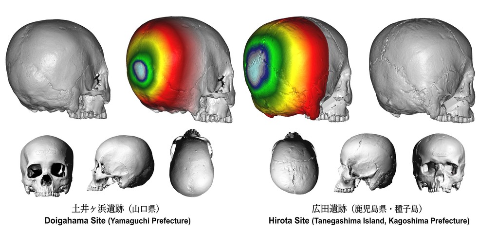 O crânio do sítio de Hirota (à direita) tem a parte de trás da cabeça mais achatada em comparação com os crânios do sítio de Doigahama (à esquerda), indicando modificação craniana intencional — Foto: Seguchi Lab/Kyushu University