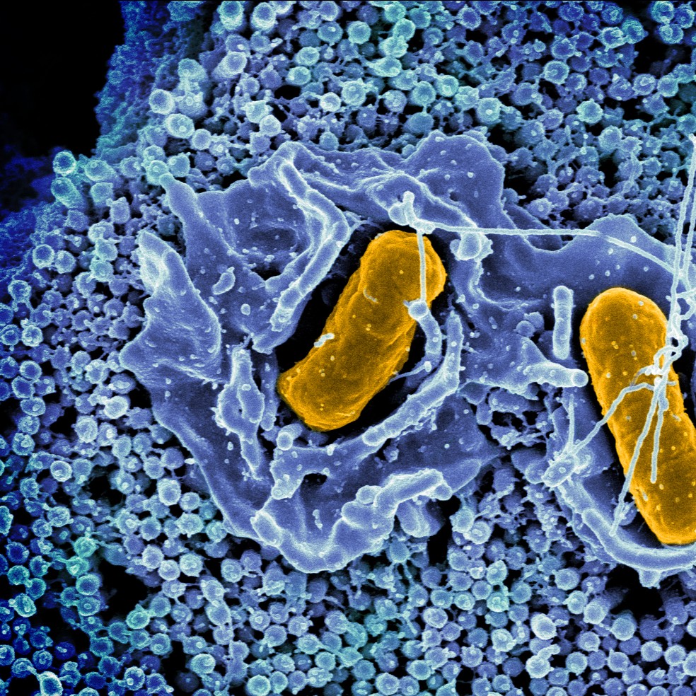 Representação de bactérias Salmonella typhimurium invadindo uma célula epitelial humana — Foto: NIAID/Wikimedia Commons