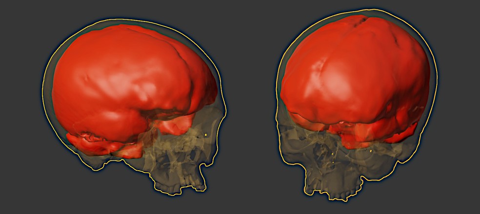 Visualização do endocrânio do indivíduo Ł3/66/90, que inspirou a aproximação facial — Foto: Moraes et al