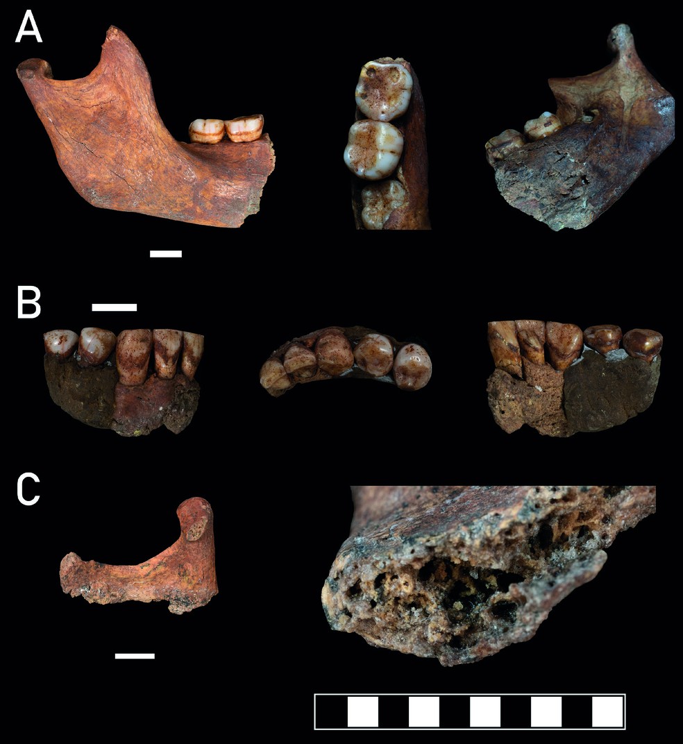 A: Parte direita da mandíbula, mostrando a vista bucal, a vista oclusal dos molares e uma vista lingual da área fraturada; escala em cm. B: Dentição anterior sobrevivente, nas vistas labial, oclusal e lingual; escala em cm. C: Fragmento sobrevivente do ramo mandibular esquerdo (escala em cm) e, em detalhe, a área fraturada (escala em mm) — Foto: Vitale Stefano Sparacello et al.