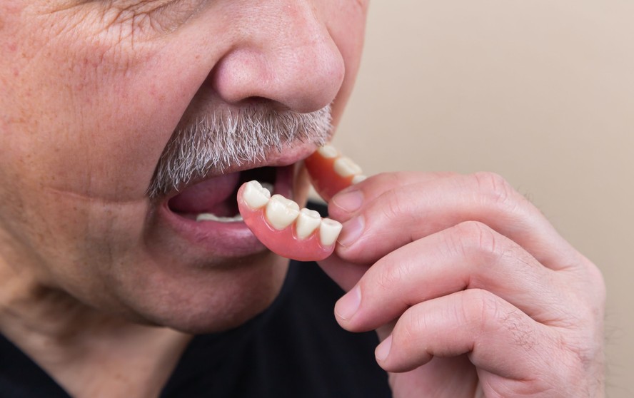 Dentaduras podem gerar mais risco de pneumonia bacteriana, segundo estudo