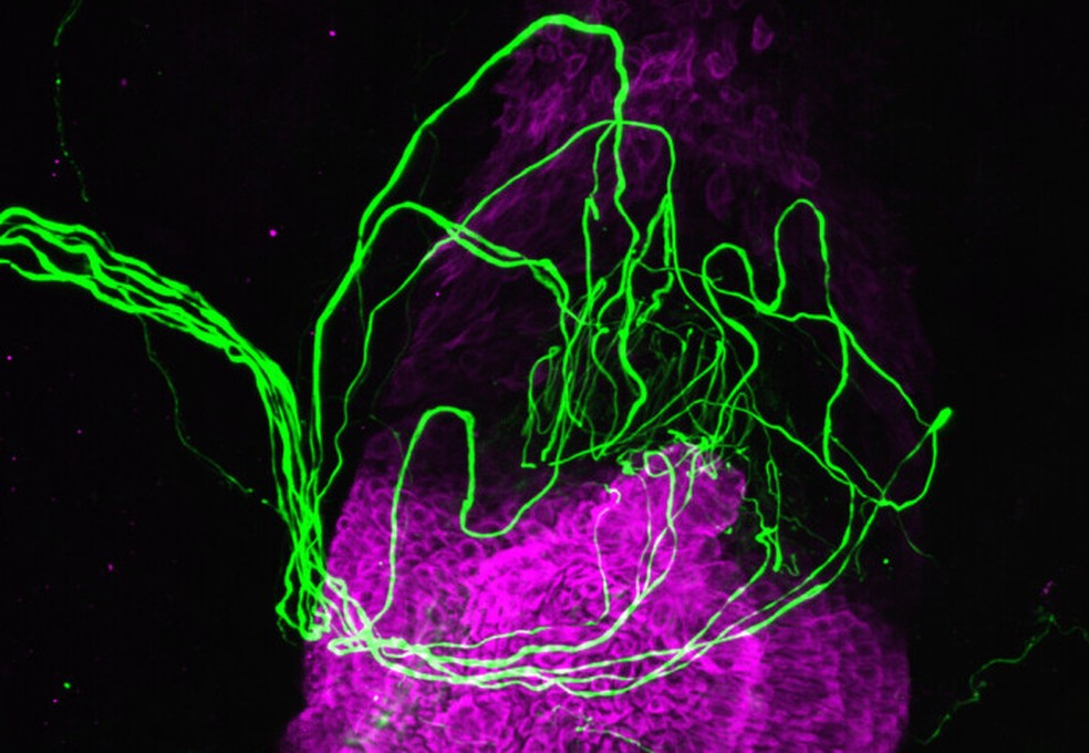 Folículo capilar (roxo) rodeado por nervos sensoriais (verde fluorescente) — Foto: Imperial College London