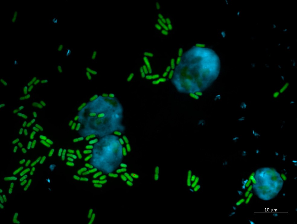 Keanumicinas são tóxica para amebas e também eficazes contra doenças fúngicas de plantas e fungos patogênicos humanos — Foto: Reprodução/Harikumar Suma, Leibniz-HKI