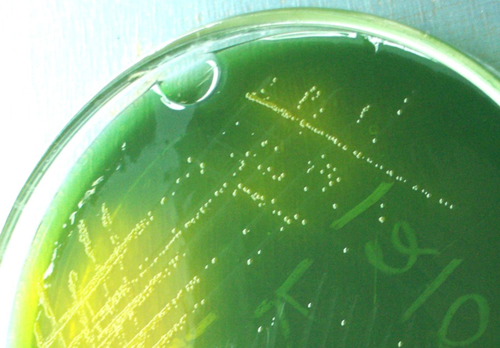 Bactéria "Vibrio cholerae" cultivada em ágar — Foto: Wikimedia Commons