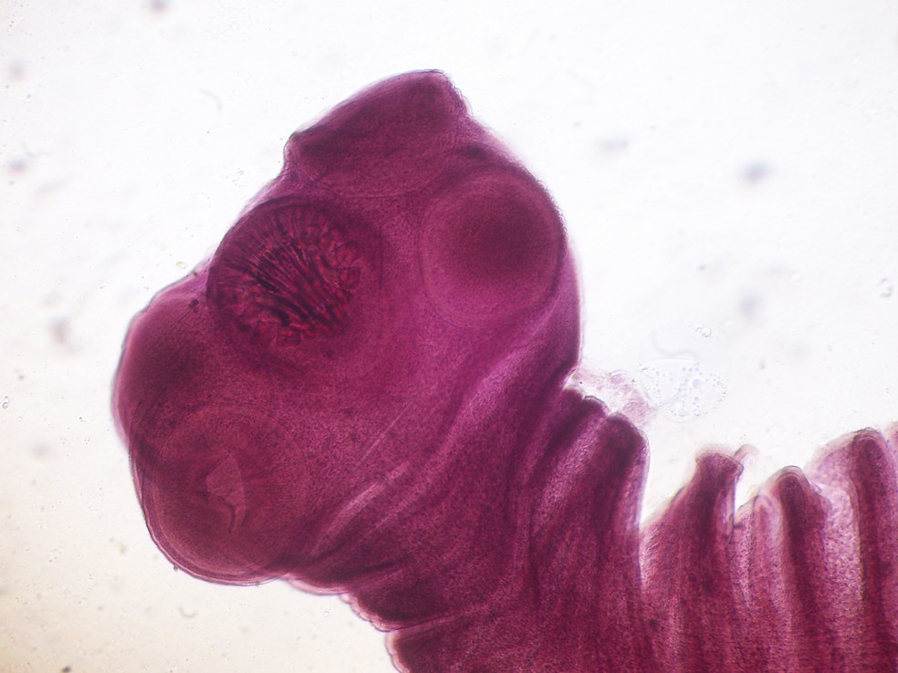 O verme "Taenia solium" — Foto: Wikimedia Commons
