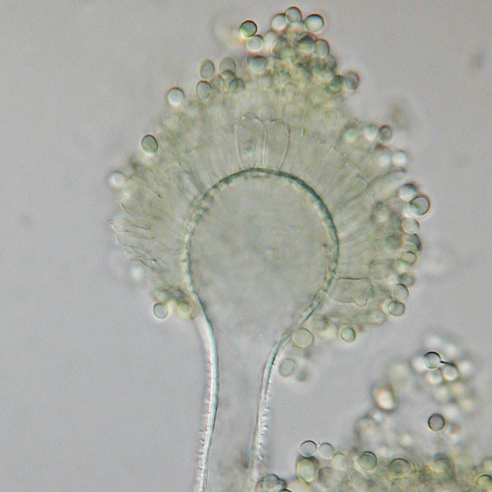O Aspergillus flavus é um patógeno oportunista e conhecido por contaminar diversos tipos de grãos armazenados — Foto: Medmyco/Wikimedia Commons