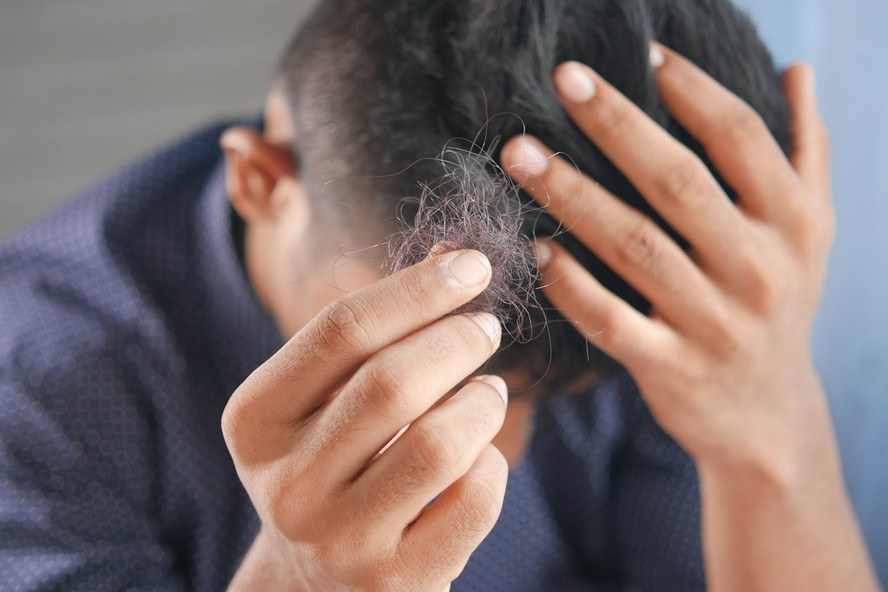 Calvície? Novo estudo revela proteína que auxilia no crescimento do cabelo