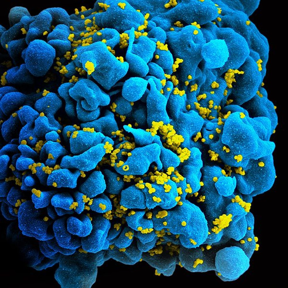 Eletromicrografia de varredura de uma célula T infectada pelo HIV — Foto: Wikimedia Commons