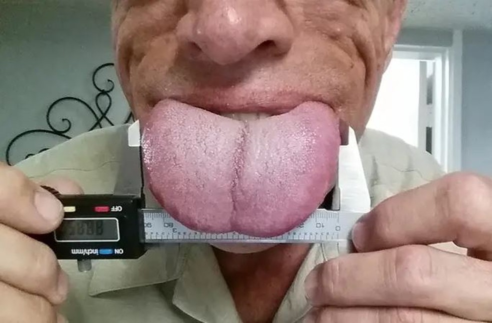 Brian Thompson é o atual recordista com uma língua de 8,88 centímetros  — Foto: Reprodução/Guinness World Records