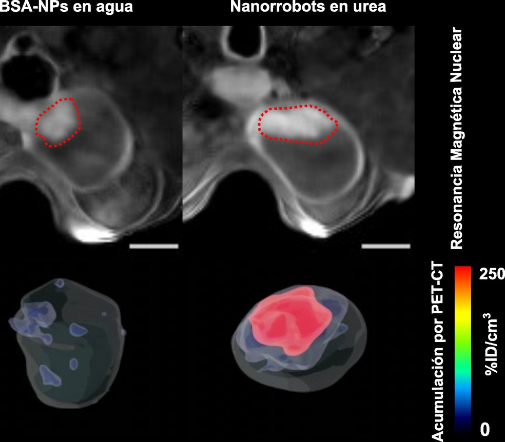 Localização de tumor de bexiga por meio de ressonância magnética e acúmulo de nanorrobôs no tumor, quantificado por tomografia por emissão de pósitrons (PET) — Foto: CIC biomaGUNE