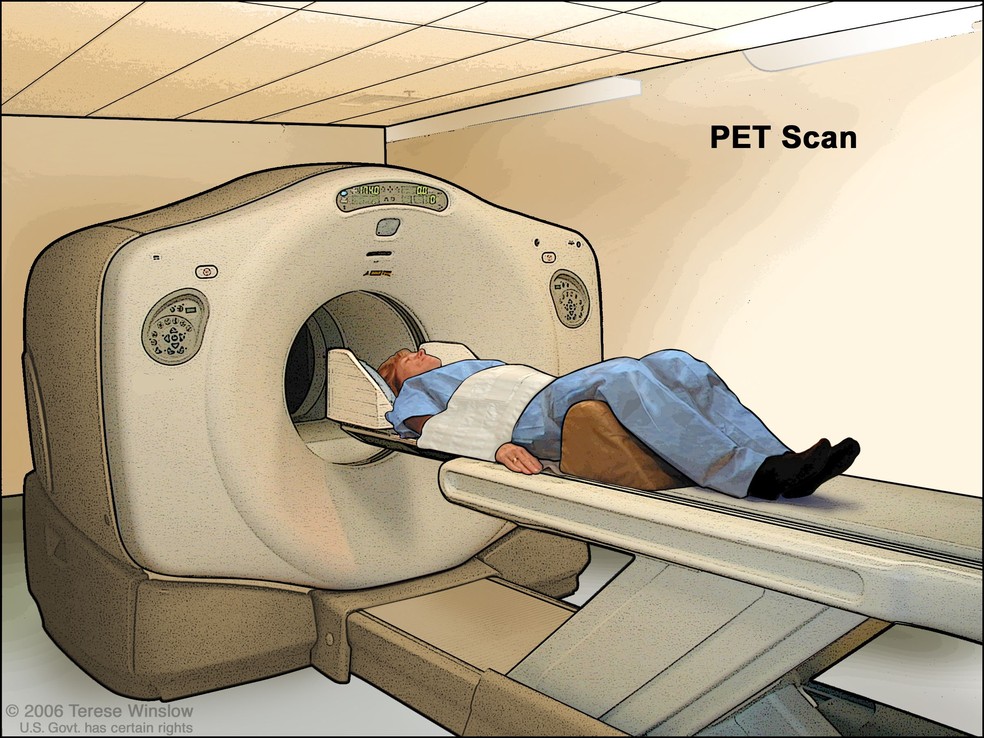 PETScan — Foto: Terese Winslow/Reprodução nci-media.cancer.gov