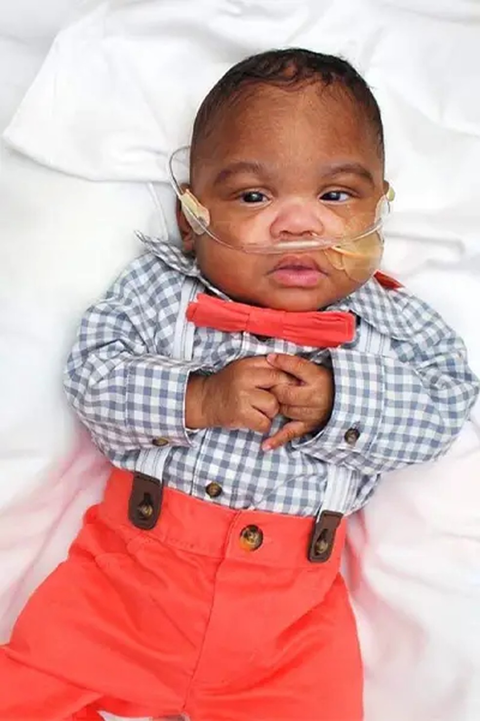 Pequeno Curtis passou 9 meses na UTI neonatal usando um tubo de oxigênio, que o ajudava a respirar — Foto: Guinness World Records