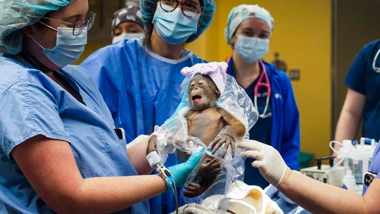 EUA: filhote de orangotango criticamente ameaçado nasce de cesária