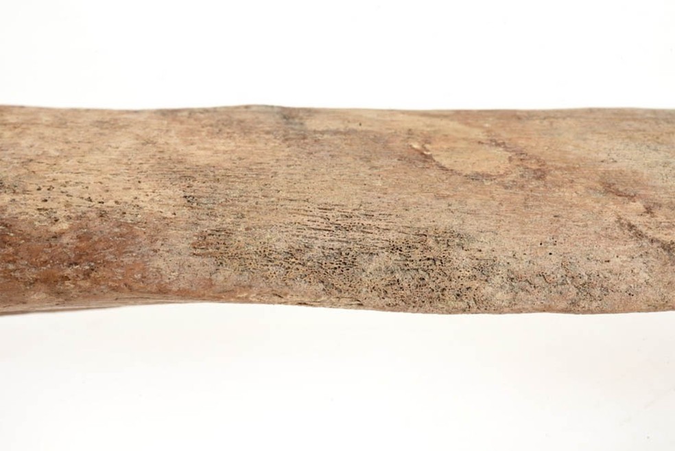 Crescimento ósseo periosteal ativo e cicatrizado na diáfise da tíbia direita — Foto: Nelly H Hercberg/ Museu Cultural de Lund