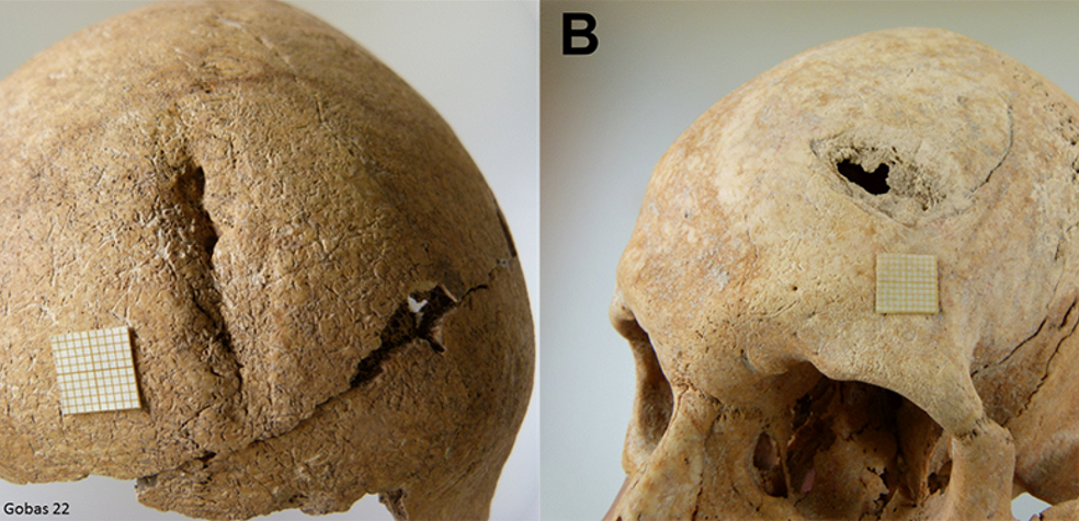 Crânios de esqueletos encontrados na vila medieval de Las Gobas mostram marcas de violência — Foto: Lourdes Herrasti