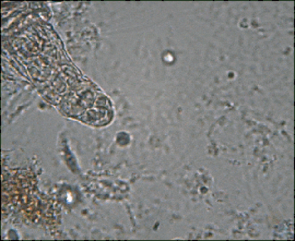 Movimentação microscópica de um rotífero — Foto: Ra'ike/Wikimedia Commons