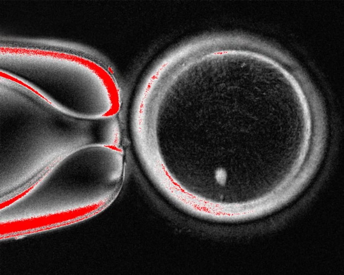 Estudo pioneiro consegue transformar células da pele humana em óvulos