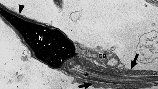 Vírus da Covid-19 pode permanecer no espermatozoide até 110 dias após a infecção