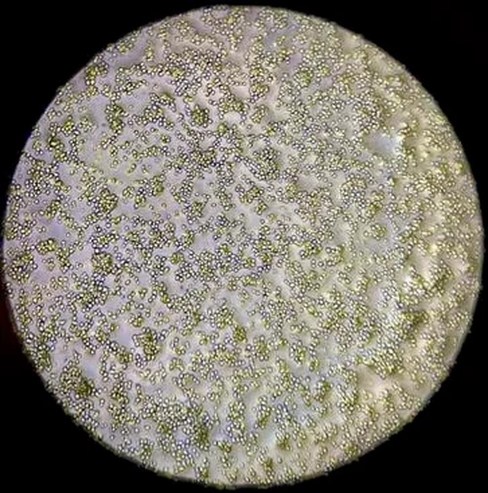 Colnias do fungo Batrachochytrium dendrobatidis (Bd)  Foto: Mark Yacoub/UCR