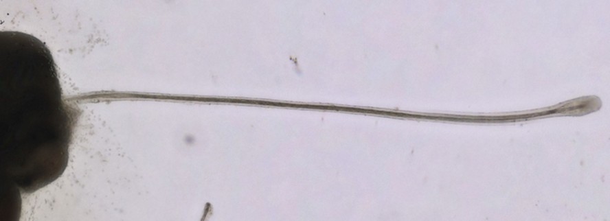 Folículo piloso de brotamento longo gerado a partir de folicloides capilares após um longo período de cultura