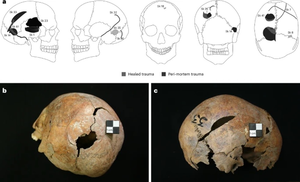 Distribuição e exemplos de lesões cranianas registradas em Gomolava — Foto: Nature Human Behaviour