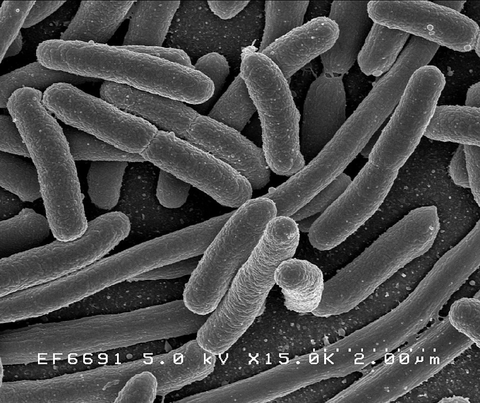 Micrografia eletrônica de varredura de Escherichia coli cultivada em cultura e aderida a uma lamínula — Foto: Wikimedia Commons