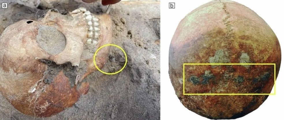 Restos de tecido foram encontrados perto da mandíbula (item A) e do osso occipital, que fica na parte posterior e inferior do crânio (item B) — Foto: Journal of Archaeological Science: Reports