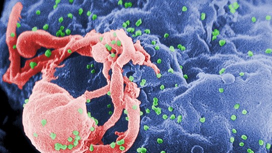 Como surgiu o vírus HIV, causador da aids? Entenda a história da doença