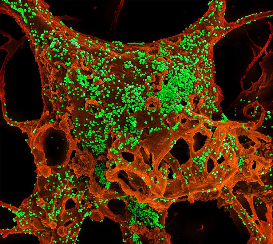 Micrografia eletrônica de varredura com cores aprimoradas de células Vero E6 infectadas com coronavírus da síndrome respiratória do Oriente Médio (MERS-CoV)