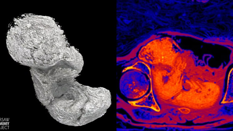 Imagens da tomografia que revelou o feto da múmia — Foto: Warsaw Mummy Project