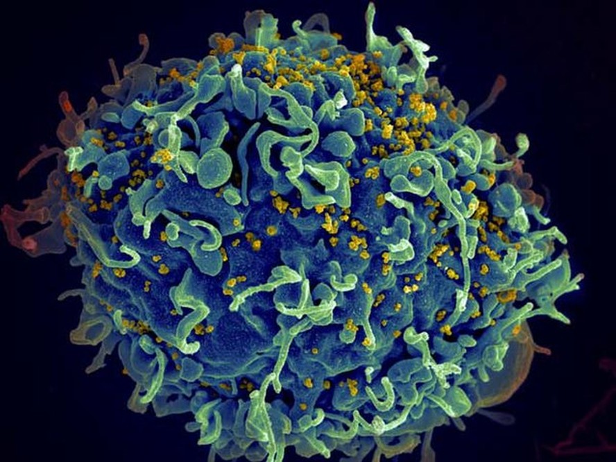 Imagem mostra uma célula T humana (azul) sendo atacada pelo HIV (amarelo), o vírus que causa a aids.
