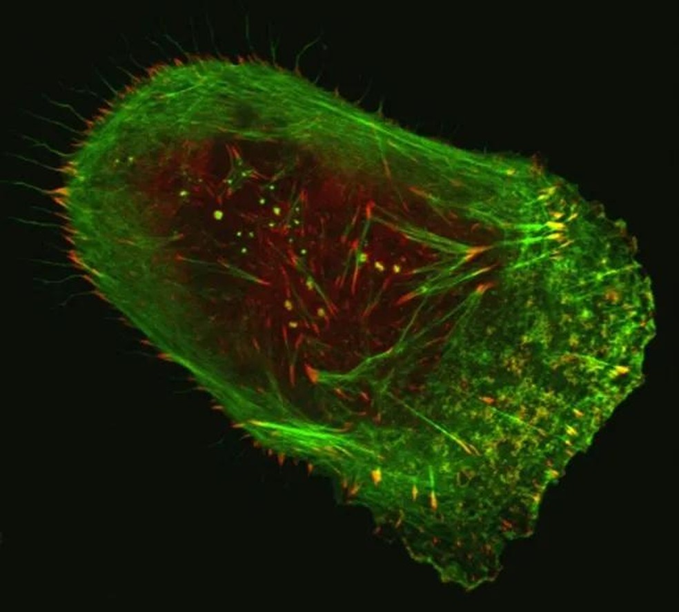 Célula de melanoma humano vista em microscópio confocal fluorescente de varredura a laser (Foto: Vira V. Artym/NIDC-NIH) — Foto: Galileu